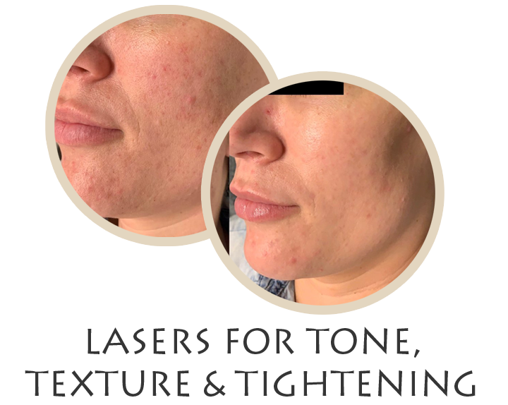  Perfect Skin Las Vegas